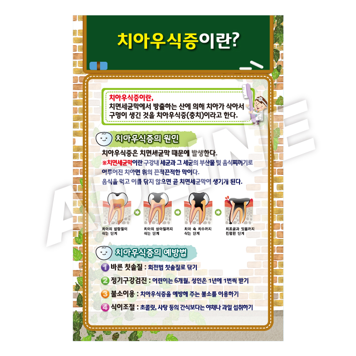 치아우식증이란